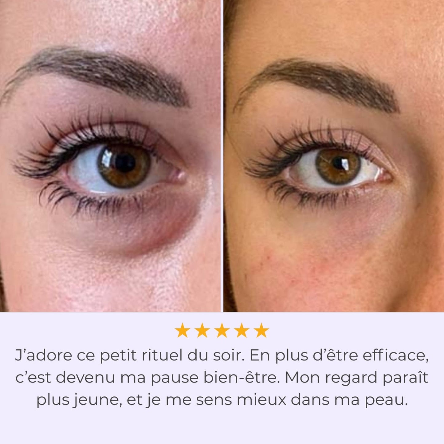LumiEyes™ - Technologie Anti-Cernes